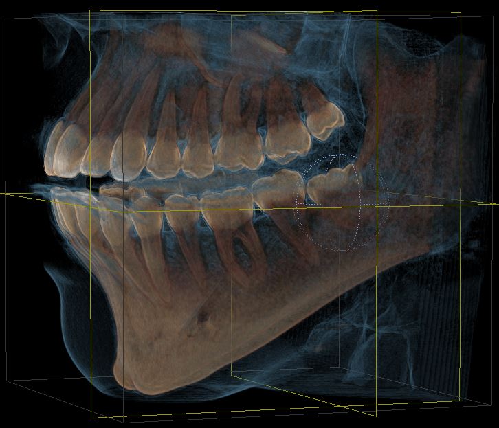 Foto: Oralchirurgie